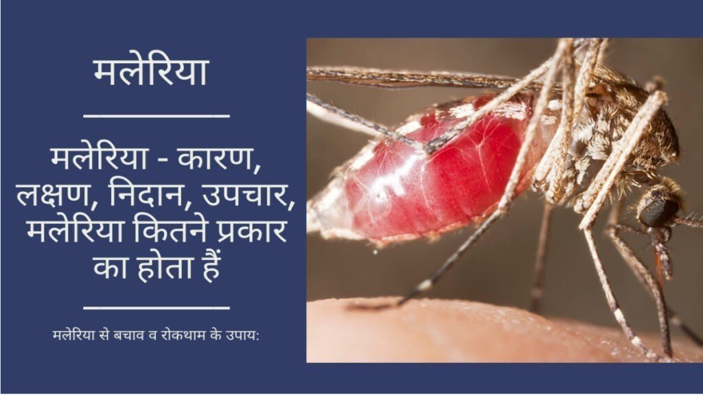Malaria kitne prak